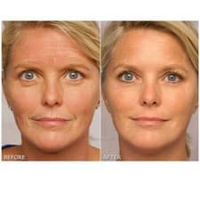Image of INSTANT FACE LIFT ANTI WRINKLE CREAM FINE LINE SERUM WORKS INSTANTLY ⭐️⭐️⭐️⭐️⭐️