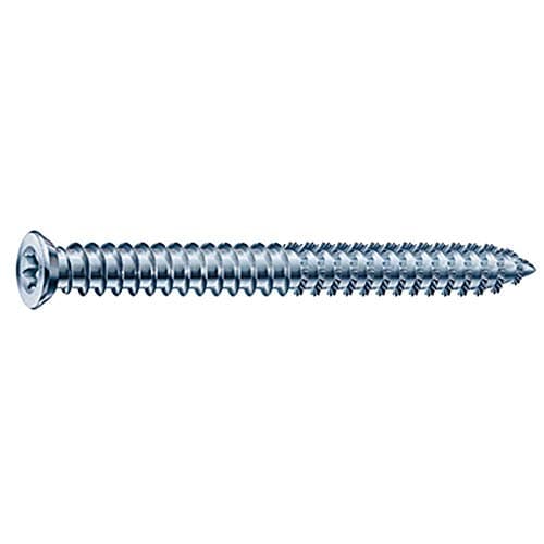 Image of SPAX T-Star Frame Anchor Screws WIROX 7.5 x 150mm - Pack of 6