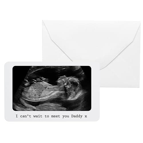 Image of Personalised Sentimental Keepsake Baby Scan White Metal Wallet Card Father's Day Birthday Gift (Organza Gift Bag Packaging)