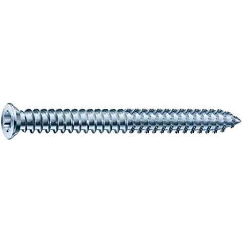 Image of Spax RA Frame Anchor Countersunk Screws - 7.5mm x 100mm - Pack of 100