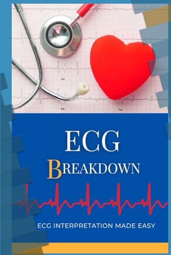Image of ECG BREAKDOWN: Made it easy- Pocket guide