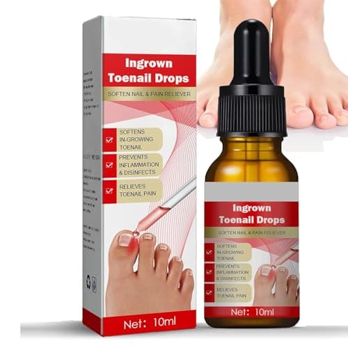 Image of Ingrown Toenail Treatment Drop, ChicNana Ingrown Toenail Treatment Cuticle Care Oils for Ingrown Toenails Trimming Toenail Softening Drops Natural Ingrown Toenail Correction Fungal Nail (10ml*1)