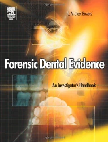 Image of Forensic Dental Evidence: An Investigator's Handbook