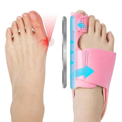 Image of ACWOO Bunion Corrector for Women and Men, Big Bunion Corrector Set with 2 x Orthopedic Bunion Splints and 2 x Big Toe Straighteners, Adjustable Hallux Valgus Correction for Day/Night Support