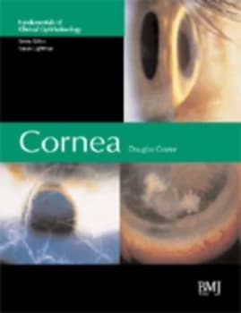 Cornea by Douglas Coster Hardback