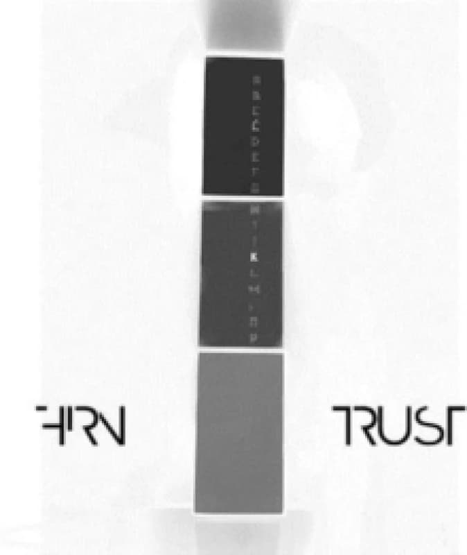 Trust Cassette Tape