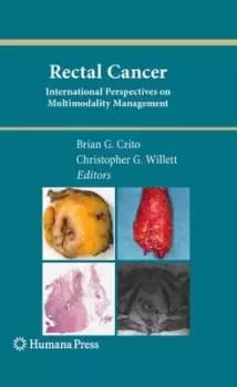 Image of Rectal cancer by Brian G. Czito