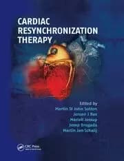 Image of Cardiac Resynchronization Therapy
