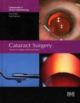 Image of Cataract Surgery by Andrew Coombes Hardback
