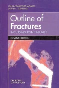 Image of Outline of Fractures Including Joint Injuries by John Crawford Adams Paperback