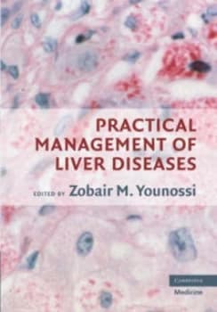Image of Practical Management of Liver Diseases by Zobair M. Younossi Hardback
