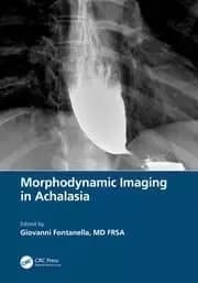 Image of Morphodynamic Imaging in Achalasia