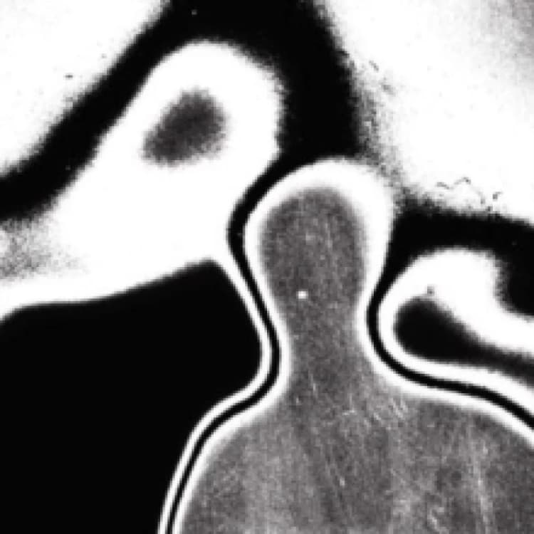 Image of Universal pressure Vinyl