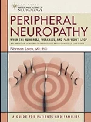 Image of peripheral neuropathy when the numbness weakness and pain wont stop