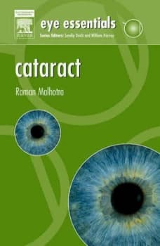 Image of Cataract by Raman Malhotra Paperback