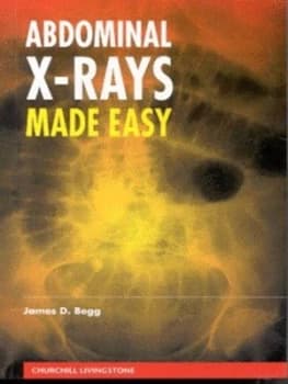 Image of Abdominal X-Rays Made Easy by James D Begg Paperback