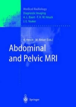 Image of Abdominal and Pelvic Mri by A. Heuck Hardback