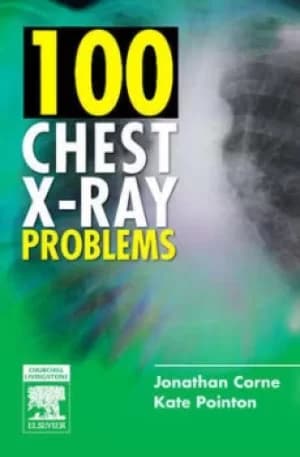 Image of 100 chest X-ray problems by Jonathan Corne