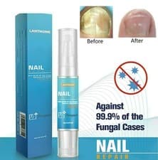 Image of Nail Fungal Treatment Pen Anti Fungus Infection Biological Repairs Solution Care