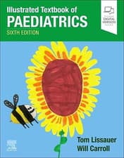 Image of Illustrated Textbook of Paediatrics the New